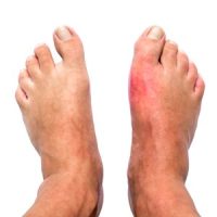 Neuropathic Pain Treatment